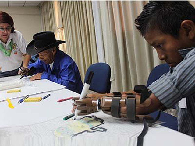 El salvador: UDB y Clubes Rotarios entregan prótesis de mano a más de 100 salvadoreños/as